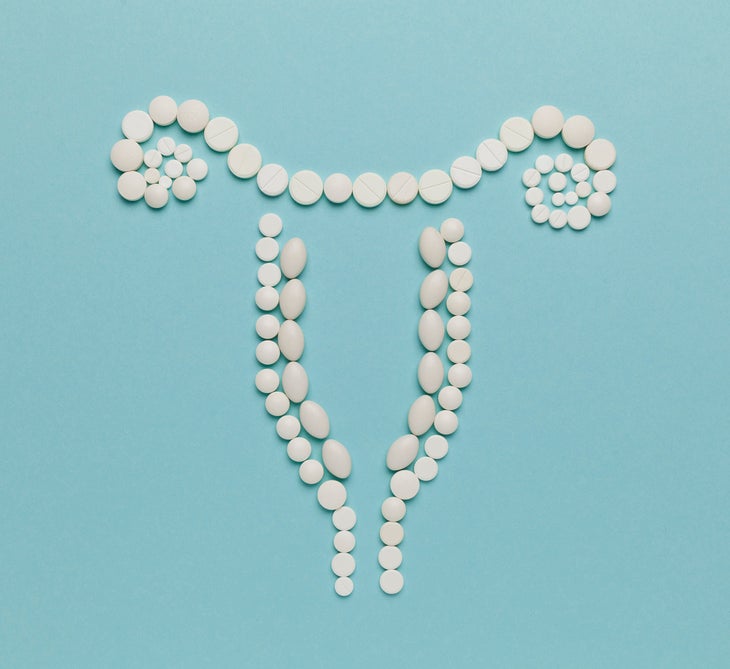 illustration of a uterus made out of small white pills; you can treat fibroids with various medications