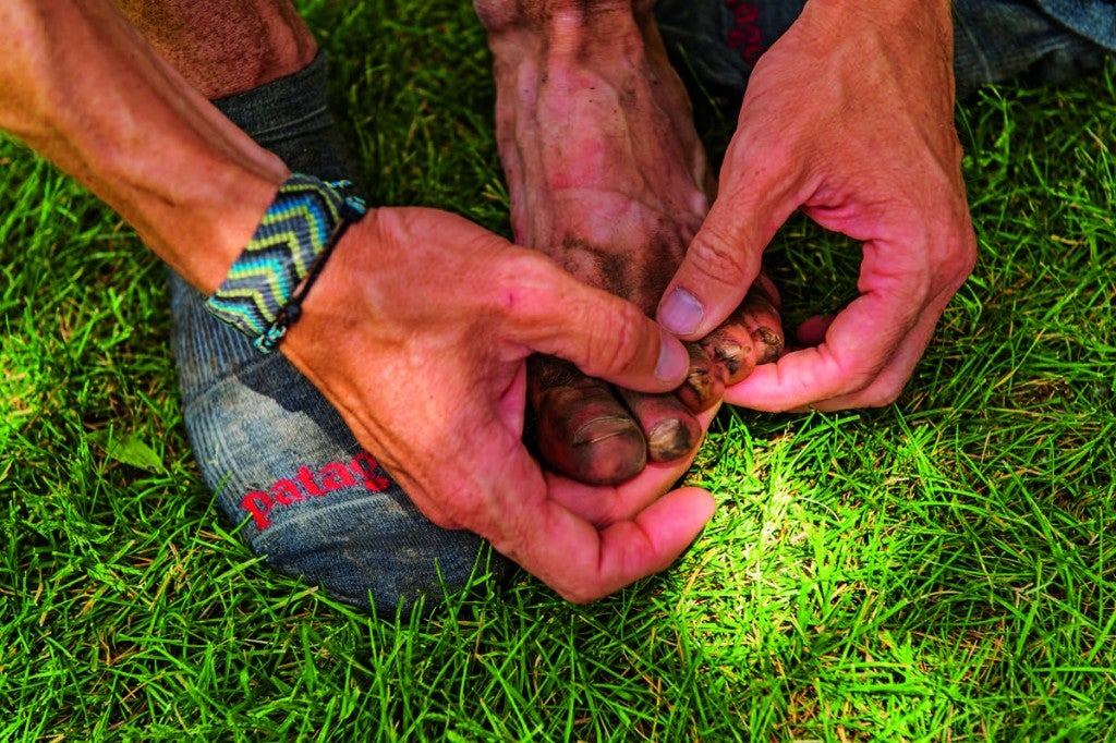The Foot Treatment An Ultrarunner Says Is Crucial Women's Running