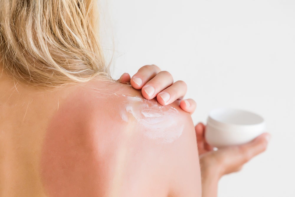 Here's How To Sleep Easier When You Have A Sunburn Women's Running